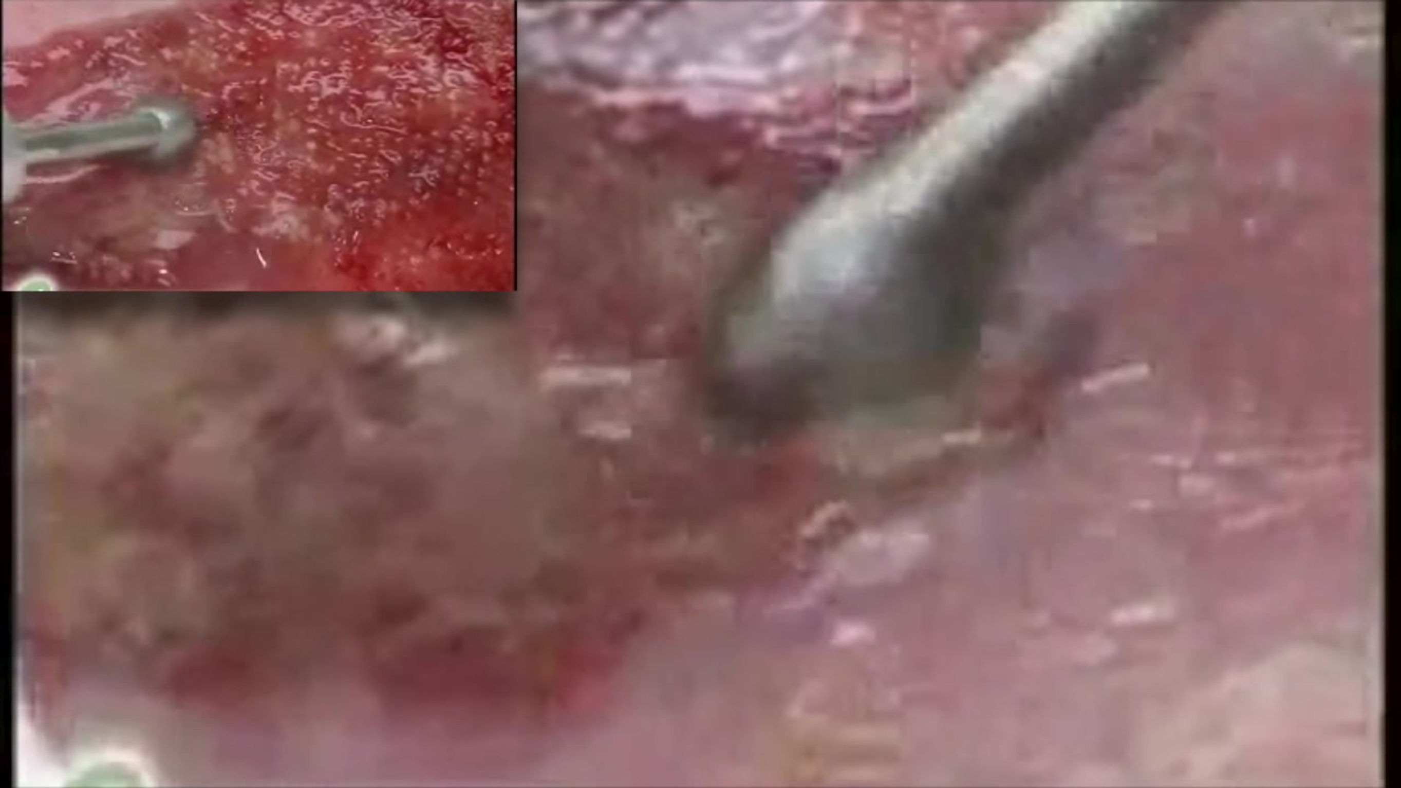 AROBELLA SAWC VIDEO 2023